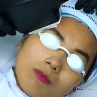 1 Alat Banyak Fungsi, Hair Removal dan Rejuvenasi Jadi Mudah!