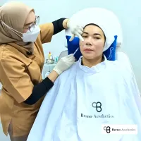 PLLA Biostimulator Injection Technique