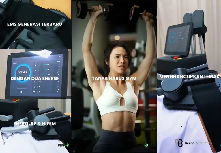 SculptX Teknologi Body Contouring Generasi Terbaru untuk Klinik Premium